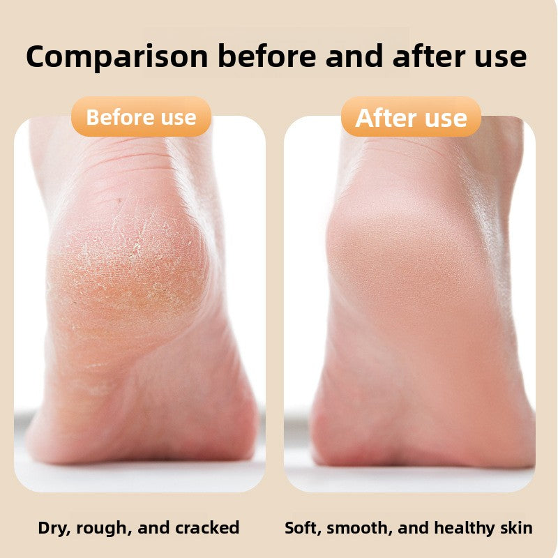 Electric Foot Grinder Dead Skin Remover