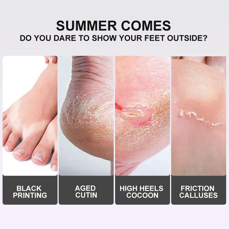 Lavender Vc Exfoliating Foot Mask Foot Care